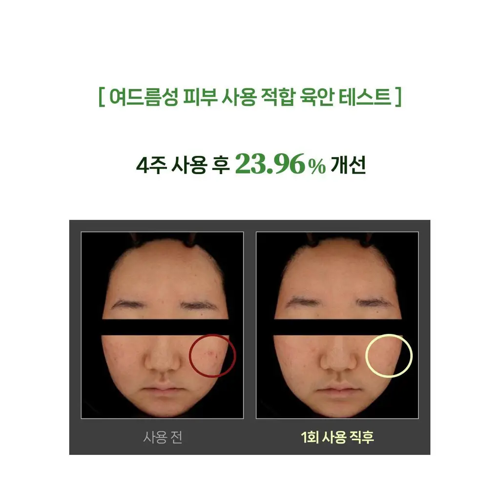 [올리브영 1위] 더마픽스 퍼펙트 퍼포먼스 콜라겐 1+1기획 (3종 1택) 상세페이지 94